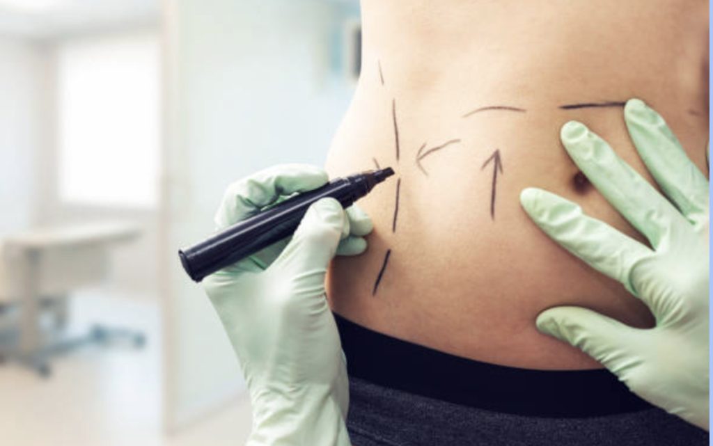 The Psychology Behind Why People Seek Body Changes - GIS user ...